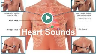 Heart Sounds S1S2S3and others [upl. by Onstad]