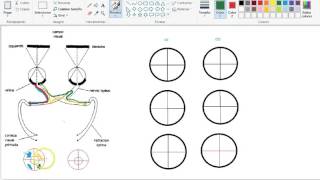 Lesiones en la vía visual representacion en campimetría [upl. by Ettenyar]