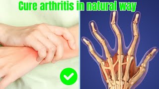 Defeat Arthritis Naturally with Healthy Diet amp Workout [upl. by Ttoile372]