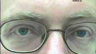 Nystagmus eye movement recording 1 [upl. by Roderigo]