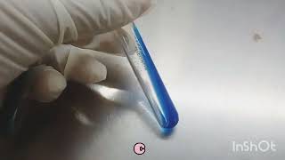 CITRATE test  Biochemicals in Microbiology  How to read [upl. by Ycnalc]