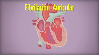 Cómo Vivir con Fibrilación Auricular [upl. by Lebaron]