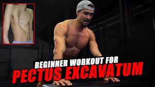 PERFECT BEGINNER WORKOUT FOR PECTUS EXCAVATUM [upl. by Zerdna]