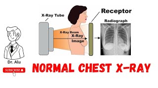 How To Read A Chest X Ray  Chest X Ray Findings  X Rays [upl. by Chelton]