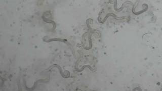 lung worms in cats  Aelurostrongylus abstrusus [upl. by Brandyn]