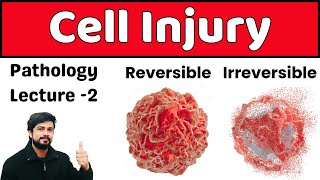 Cell Injury  Types of Cell Injury  Reversible  Irreversible  Pathology Lecture 2  Hindi [upl. by Ynaffital]