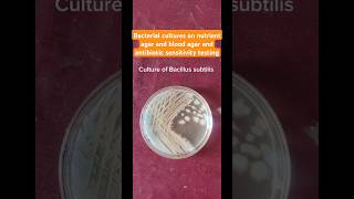 Bacillus subtilis Enterococcus fecalis Desulfovibrio cultures and colonies health microbiology [upl. by Dill]