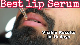 Effective Lip Serum for Dark Lips  No Chemicals  உங்க லிப்ஸ் டார்க்கா இருந்தா இது try பண்ணுங்க [upl. by Aurelio]