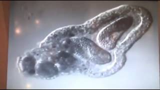 Amoeba eats two paramecia Amoebas lunch [upl. by Ordnaxela]