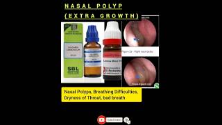 Medicine for polyp soft growths inside your nose Top homoeopathic [upl. by Adnuahsal]