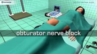 Obturator Nerve Block [upl. by Aneehsit963]