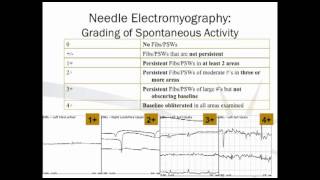 Electrodiagnostic Testing [upl. by Varian]