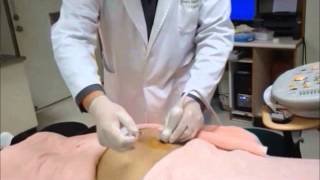 UltrasoundGuided Sacroiliac Joint Injection Technique [upl. by Enelez843]