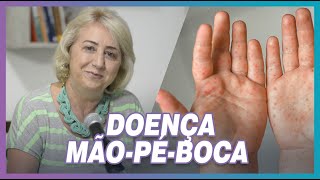 DOENÇA MÃOPÉBOCA O que é diagnóstico sintomas e tratamento I SAÚDE EM SEU LAR [upl. by Yrrad]