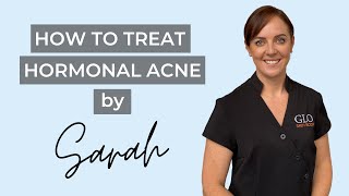 How to Treat Hormonal Acne [upl. by Furr]