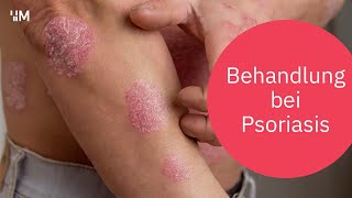 Psoriasis Behandlungsmöglichkeiten wenn die Haut in Flammen steht  Schuppenflechte [upl. by Enrahs770]