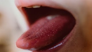 10 Common HIV Symptoms In Women That You Shouldnt Ignore [upl. by Naujaj]