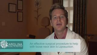 Surgical and NonSurgical Neck Lift Options [upl. by Archibaldo]