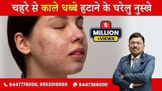 Black spots on skin and its natural remedies  Dr Bimal Chhajer  SAAOL [upl. by Asselim]