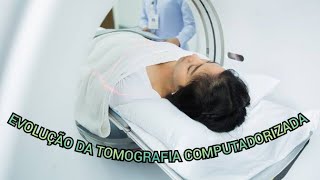 EVOLUÇÃO DA TOMOGRAFIA COMPUTADORIZADA [upl. by Grath]