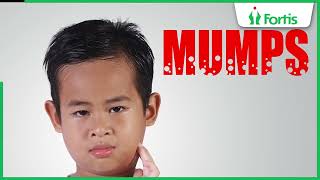 Learn about Mumps Symptoms Causes and Treatments with Dr Neetu Talwar [upl. by Hazeefah]