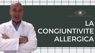 La congiuntivite allergica [upl. by Pettit564]