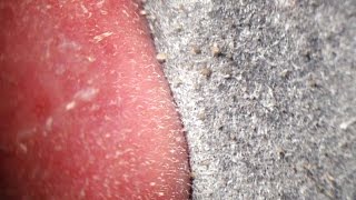 Pore Strips removal close up Blackheads removal [upl. by Noni]