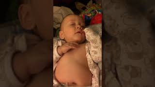 Example of Retractions Belly Breathing and Tachypnea in Infant [upl. by Waldon207]