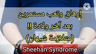 متلازمة شيهانSheehan Syndrome [upl. by Rosalinde]