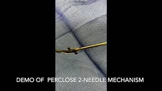 Perclose 2 needle mech [upl. by Ashling]