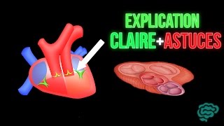 🔴 EXPLICATION CLAIRE ET ASTUCES POUR LES VALVES CARDIAQUES  DR ASTUCE [upl. by Airebma]