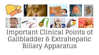 Clinical anatomy of gallbladder and extrahepatic biliary apparatus gallbladder clinicalanatomy [upl. by Marysa556]