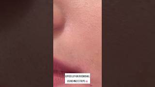 Upper Lip Hair Removal Using Wax Strips shortsfeed makeup upperlip hairremoval hair shorts [upl. by Fidelia325]