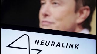 Neuralink вживила первый чип в мозг человека [upl. by Legna]