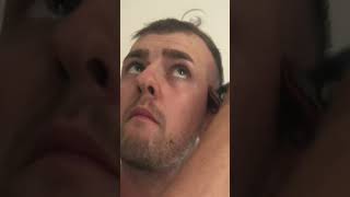 BALDING At 22 First Time BUZZ CUT [upl. by Notsnorb]