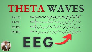 Theta Waves on the EEG [upl. by Elcarim947]