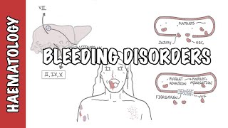 Approach to bleeding disorders  causes pathophysiology and investigations [upl. by Nylatsirhc]