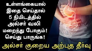 அல்சர் குணமாக வீட்டு வைத்தியம்  Ulcer Treatment in Tamil Ulcer Symptoms in Tamil Tamil Health Tips [upl. by Di]