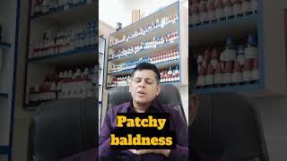 Best Homoeopathic medicine for baldness [upl. by Ajani]