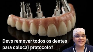 Quando devo tirar todos os dentes e colocar protocolo  Dra Bianca Rosa  Clínica Bianca Rosa [upl. by Dolph]