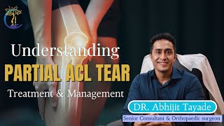 Partial ACL Tear  Do You Really Need Surgery  Dr Abhijit Tayade  Orthopedic Surgeon  New Delhi [upl. by Ross]