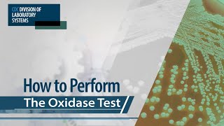 How to Perform the Oxidase Test [upl. by Etirugram]