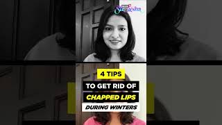 Say ByeBye To Chapped Lips  Easy amp Natural Remedies [upl. by Allimac]