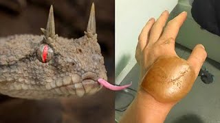 20 Most Painful Snake Bites In The World [upl. by Nnoryt133]