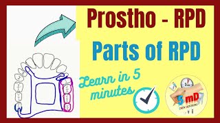 RPD  PARTS OF REMOVABLE PARTIAL DENTURE  Prosthodontics [upl. by Piegari]