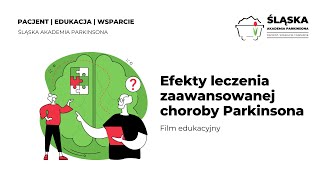 Efekty leczenia zaawansowanej choroby Parkinsona  historia p Halinki [upl. by Olemrac]