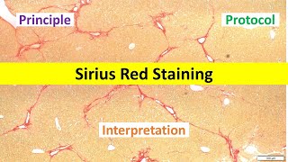 Sirius Red Staining Made Easy Beginners Overview  Principle Protocol amp Interpretation Tips [upl. by Jezabella740]