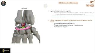 Imagerie des pathologies du DCSS [upl. by Eyllib364]