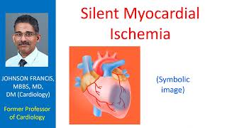 Silent myocardial ischemia [upl. by Merta]