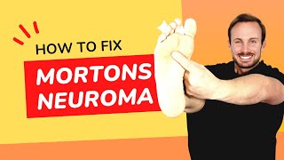 Shooting Sharp Foot Pain  Mortons Neuroma  Treatment No Surgery [upl. by Enirac]